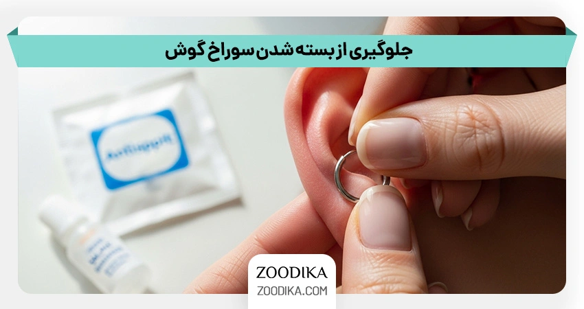 جلوگیری از بسته شدن سوراخ گوش