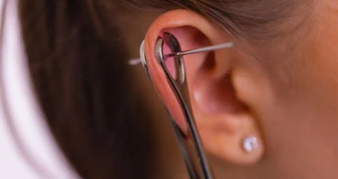 سوراخ کردن گوش با سوزن